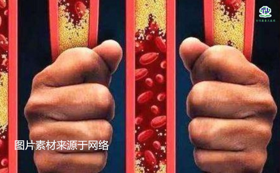 不想給血管&ldquo;添堵&rdquo;，盡量少吃以下這些東西，或許能讓腦梗離遠(yuǎn)些  